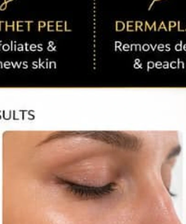 After treatment appearance